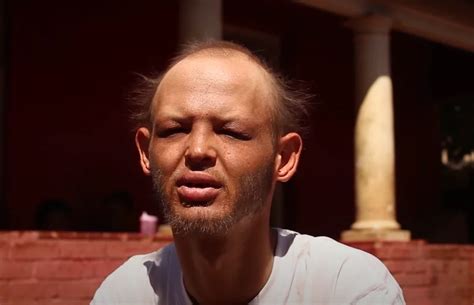 tokkie jones condition